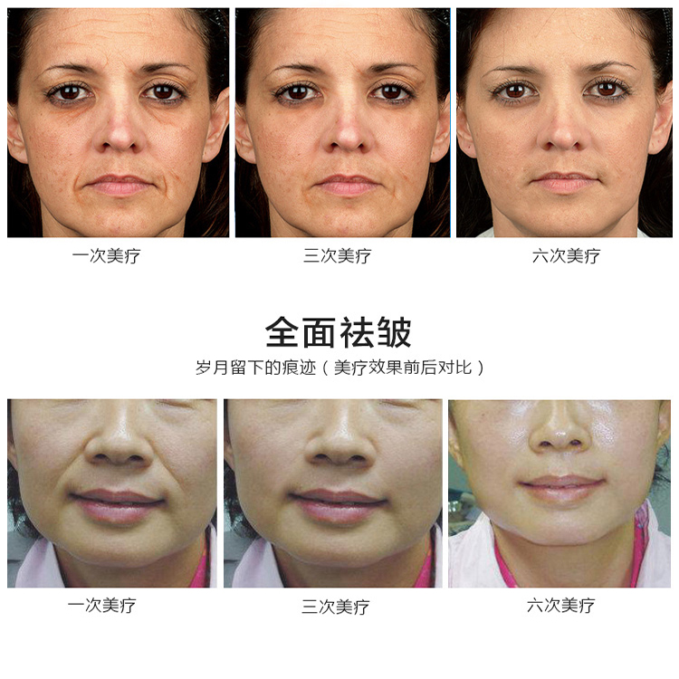 新款漩渦雷達(dá)精雕儀7.jpg