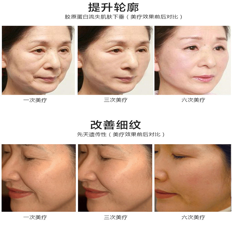 新款漩渦雷達(dá)精雕儀8.jpg