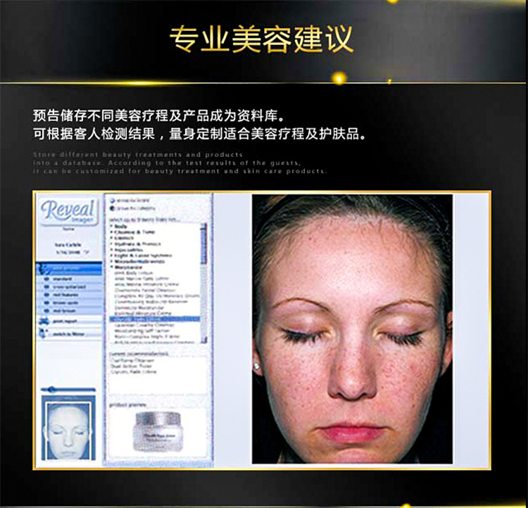 Reveal皮膚檢測(cè)儀.4.jpg