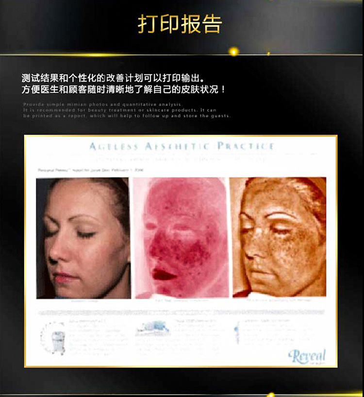 Reveal皮膚檢測(cè)儀.5.jpg
