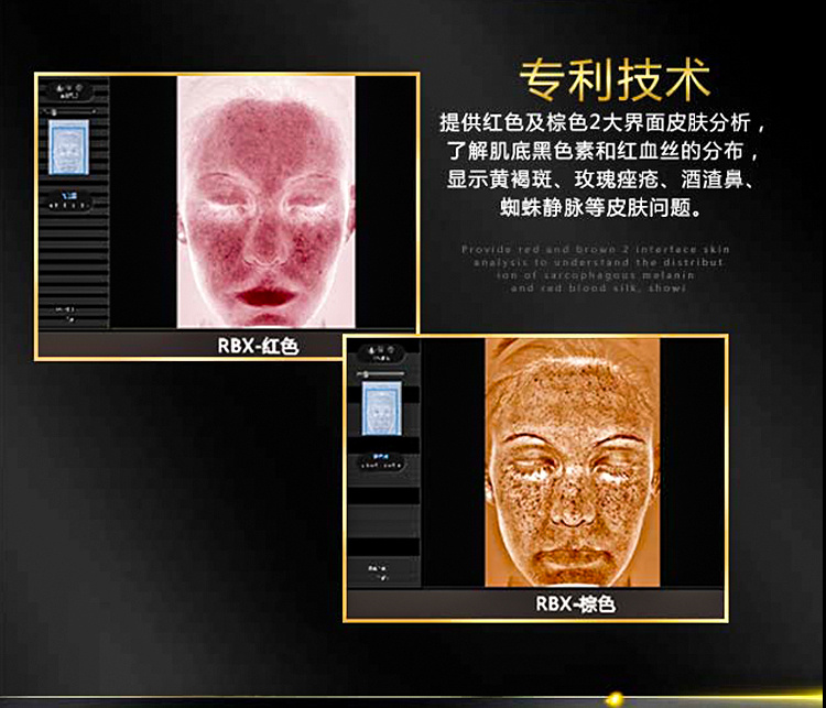 Reveal皮膚檢測(cè)儀.6.jpg
